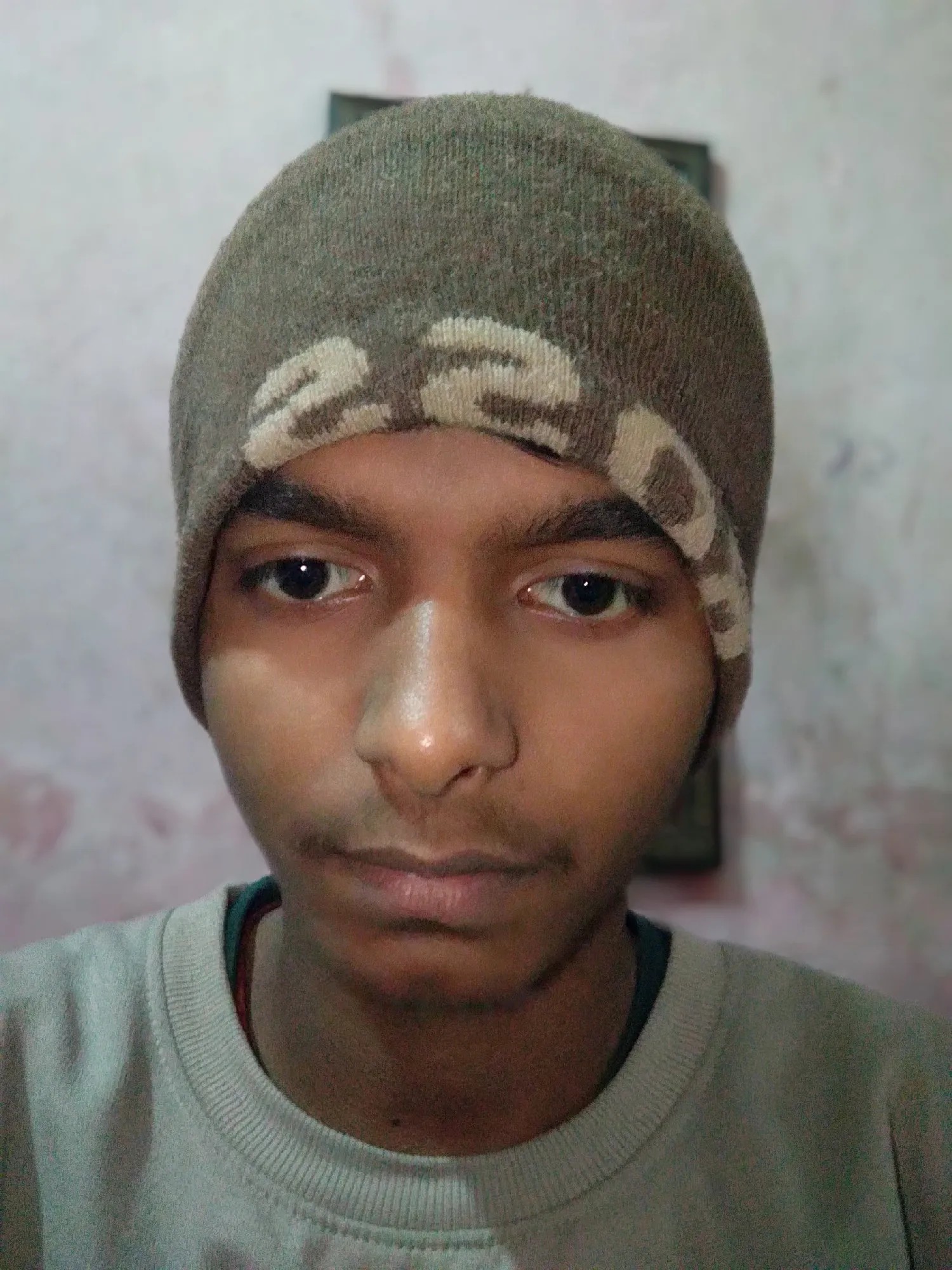 Xiaomi Redmi 5 Plus (Redmi Note 5)