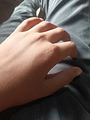 Xiaomi Redmi 5 Plus (Redmi Note 5)